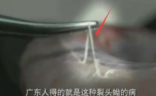 野味交易的游击战争