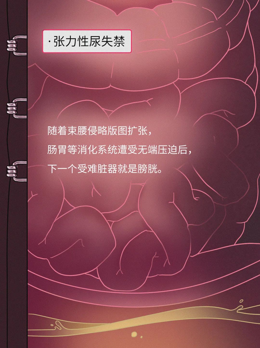 内脏下垂、子宫脱落、漏尿…月销10w的网红束腰是如何毁掉中国女孩的？