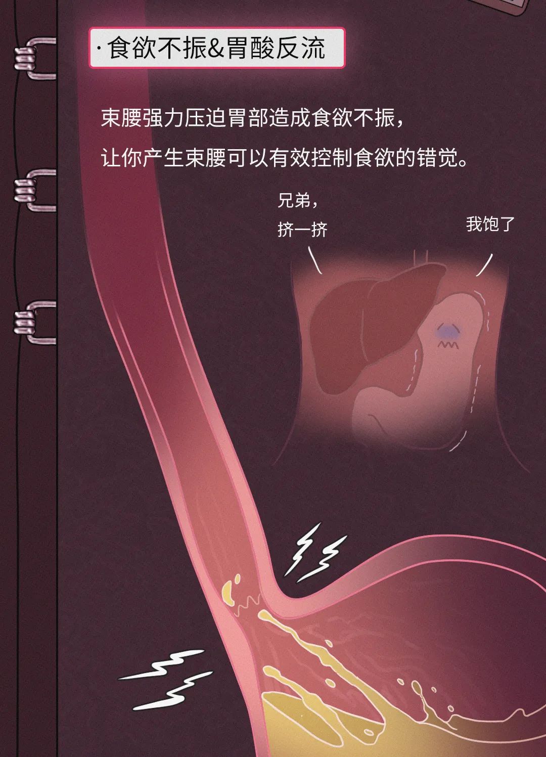 内脏下垂、子宫脱落、漏尿…月销10w的网红束腰是如何毁掉中国女孩的？