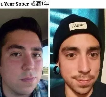 柳叶刀：每个喝酒上脸的人，都有更高患癌风险