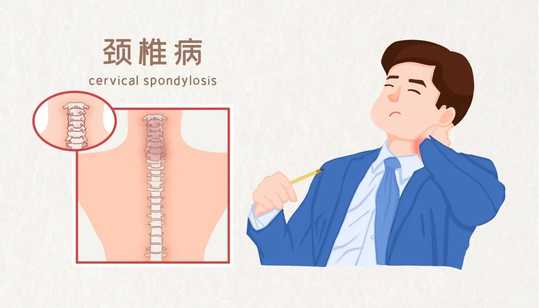 十二个动作远离久坐危害！搬砖人，快跟中山专家一起做工间“十二式”~