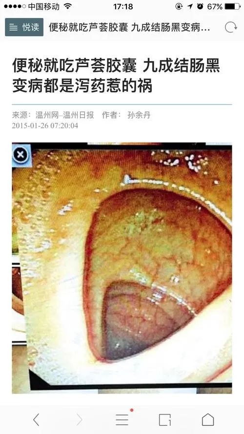 “3年酵素”、“2年排毒养颜”保健出了肠道黑变病