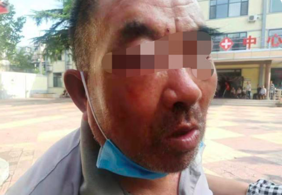 400万住顶级养老院,两个月去世……他的死亡撕开了人性最可怕的真相 400万住顶级养老院,两个月去世……他的死亡撕开了人性最可怕的真相