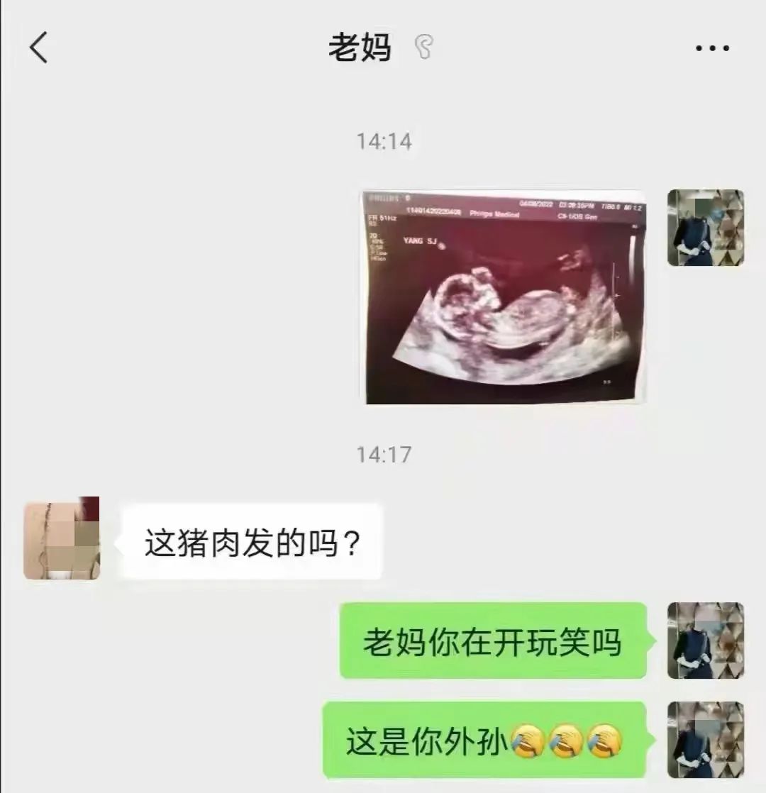 奥密克戎真正的可怕之处在于「额外死亡」？有人翻出了中疾控一年多前的论文……
